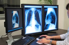 Radiology Doctors